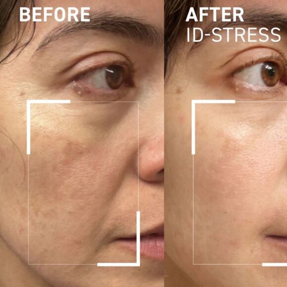 Dr. Brandt ID Stress Icy Gel Moisturizer - Picture 6 of 9